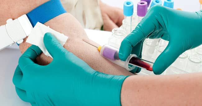 How to Read a CBC (Complete Blood Count) Test Report