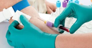 How to Read a CBC (Complete Blood Count) Test Report