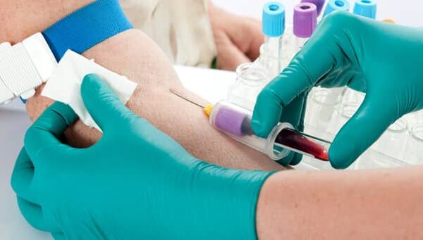 How to Read a CBC (Complete Blood Count) Test Report