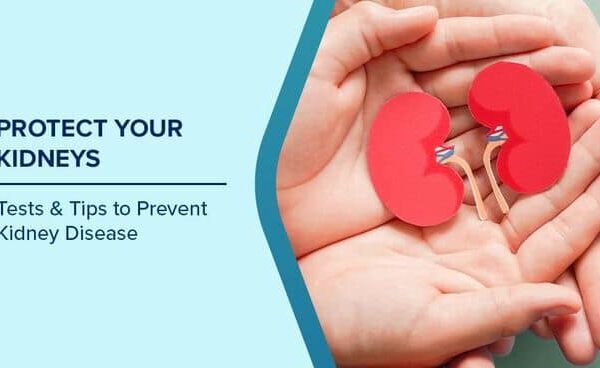 What Causes High Creatinine Levels and How to Protect Your Kidneys